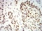 Mouse Monoclonal Antibody to UHRF1